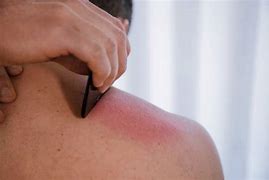 Guasha therapie